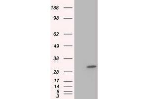 Image no. 1 for anti-Ketohexokinase (KHK) antibody (ABIN1499024) (Ketohexokinase 抗体)