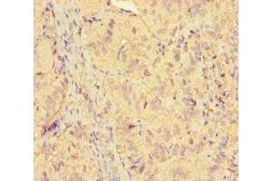 Immunohistochemistry of paraffin-embedded human adrenal gland tissue using ABIN7158468 at dilution of 1:100 (ICE1 (AA 1213-1505) 抗体)
