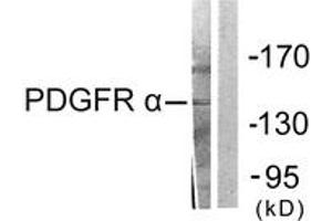 Western blot analysis of extracts from HepG2 cells, using PDGFR alpha Antibody. (PDGFRA 抗体  (AA 1031-1080))