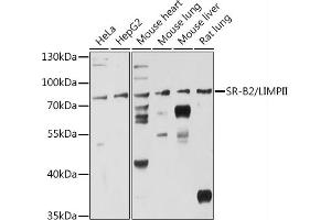 Western blot analysis of extracts of various cell lines, using SR-B2/LIMPII antibody (ABIN6127596, ABIN6147412, ABIN6147414 and ABIN6216462) at 1:3000 dilution. (SCARB2 抗体  (AA 200-380))