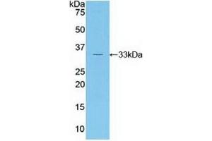 Detection of Recombinant RORg, Human using Polyclonal Antibody to RAR Related Orphan Receptor Gamma (RORg)