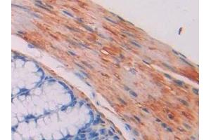 Immunohistochemistry (IHC) image for anti-Myosin Light Chain Kinase (MYLK) (AA 1684-1884) antibody (ABIN7439105)