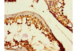 Immunohistochemistry of paraffin-embedded human testis tissue using ABIN7146159 at dilution of 1:100 (C2CD3 抗体  (AA 2079-2265))