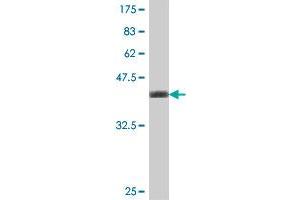 Western Blot detection against Immunogen (37. (TBCB 抗体  (AA 31-130))