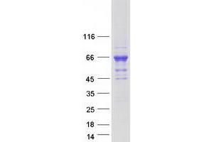 Western Blotting (WB) image for Calcium/calmodulin-Dependent Protein Kinase Kinase 2, beta (CAMKK2) (Transcript Variant 7) protein (Myc-DYKDDDDK Tag) (ABIN2713099)