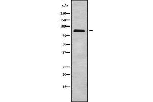Western Blotting (WB) image for anti-Excision Repair Cross-Complementing Rodent Repair Deficiency, Complementation Group 2 (ERCC2) (C-Term) antibody (ABIN6261589)