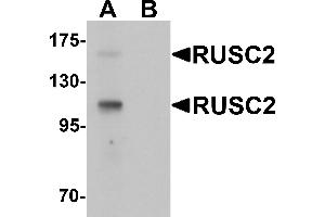 Western blot analysis of RUSC2 in SK-N-SH cell lysate with RUSC2 antibody at 1 µg/mL in (A) the absence and (B) the presence of blocking peptide (RUSC2 抗体  (N-Term))