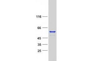 Validation with Western Blot (MEIS2 Protein (Transcript Variant F) (Myc-DYKDDDDK Tag))