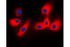Immunofluorescent analysis of 14-3-3 epsilon staining in NIH3T3 cells. (YWHAE 抗体  (C-Term))