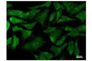 Immunostaining analysis in HeLa cells. (COX4NB 抗体)