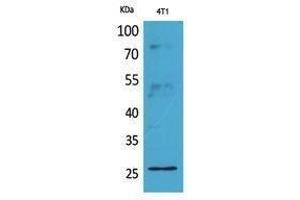 Western Blotting (WB) image for anti-CD81 (CD81) (Internal Region) antibody (ABIN3187900) (CD81 抗体  (Internal Region))