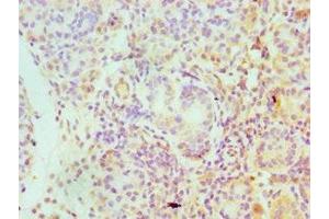 Immunohistochemistry of paraffin-embedded human pancreatic tissue using ABIN7157225 at dilution of 1:100 (SERPINA4 抗体  (AA 178-427))