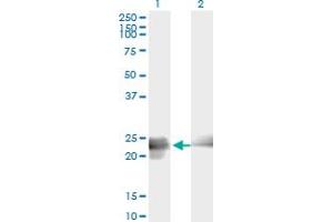 Western Blot analysis of BIN3 expression in transfected 293T cell line by BIN3 monoclonal antibody (M01A), clone 3G3. (BIN3 抗体  (AA 1-199))