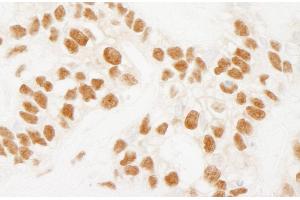anti-RD RNA Binding Protein (RDBP) (AA 330-380) antibody