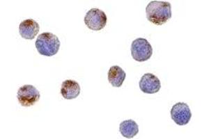 Immunohistochemistry (IHC) image for anti-Complement C1q Tumor Necrosis Factor-Related Protein 6 (C1QTNF6) (C-Term) antibody (ABIN1030348) (CTRP6 抗体  (C-Term))