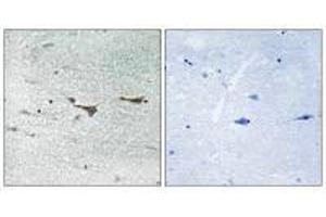 Immunohistochemistry analysis of paraffin-embedded human brain tissue using TOB1 (Ab-164) antiobdy. (Protein Tob1 (TOB1) (Ser164) 抗体)