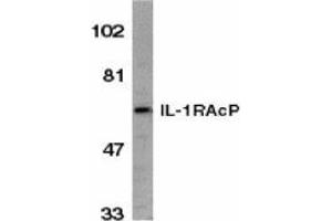 Western blot analysis of IL-1RAcP in HeLa whole cell lysate with AP30411PU-N IL-1RAcP antibody (C2) at 1/1000 dilution. (FBXO43 抗体  (C-Term))
