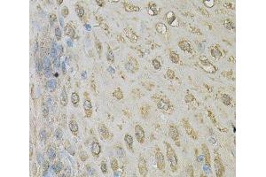 Immunohistochemistry of paraffin-embedded Human esophagus using ALDH3A1 Polyclonal Antibody at dilution of 1:100 (40x lens). (ALDH3A1 抗体)
