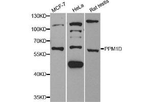 Western Blotting (WB) image for anti-Protein Phosphatase, Mg2+/Mn2+ Dependent, 1D (PPM1D) antibody (ABIN1882331) (PPM1D 抗体)