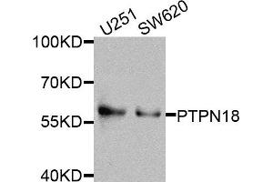 Western blot analysis of extracts of various cells, using PTPN18 antibody. (PTPN18 抗体)