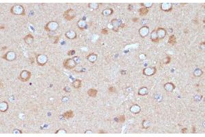 Immunohistochemistry of paraffin-embedded Mouse brain using COPG2 Polyclonal Antibody at dilution of 1:100 (40x lens). (COPG2 抗体)