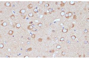 Immunohistochemistry of paraffin-embedded Mouse brain using COPG2 Polyclonal Antibody at dilution of 1:100 (40x lens). (COPG2 抗体)