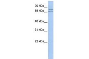 Image no. 1 for anti-DEAD (Asp-Glu-Ala-Asp) Box Polypeptide 27 (DDX27) (AA 35-84) antibody (ABIN6742687) (DDX27 抗体  (AA 35-84))