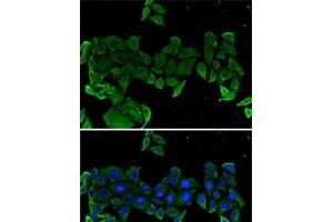 Immunofluorescence analysis of U2OS cells using COMP Polyclonal Antibody (COMP 抗体)