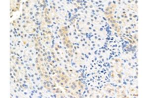 ABIN6260811 and ABIN6272991 at 1/100 staining Rat kidney tissue by IHC-P.