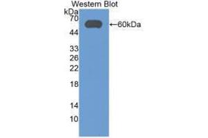 Western blot analysis of recombinant Human ALDH7A1.