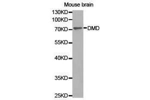 Western Blotting (WB) image for anti-Dystrophin (DMD) antibody (ABIN1872293) (Dystrophin 抗体)