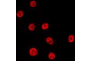 ABIN6274041 staining Hela by IF/ICC. (PTBP2 抗体  (Internal Region))