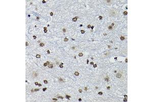 Immunohistochemistry (IHC) image for anti-Cyclin K (CCNK) (AA 1-160) antibody (ABIN6138098)