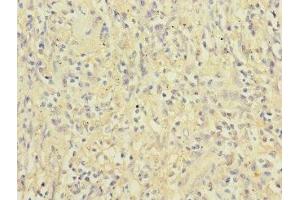 Immunohistochemistry (IHC) image for anti-Integrin, alpha X (Complement Component 3 Receptor 4 Subunit) (ITGAX) (AA 100-350) antibody (ABIN7156472)