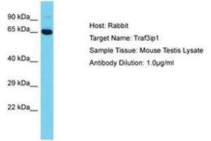Image no. 1 for anti-TNF Receptor-Associated Factor 3 Interacting Protein 1 (TRAF3IP1) (AA 42-91) antibody (ABIN6750346) (TRAF3IP1 抗体  (AA 42-91))