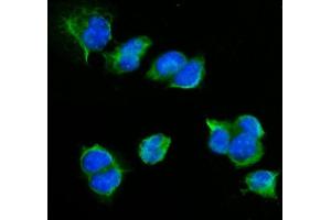 IF analysis of CD72 using anti-CD72 antibody (ABIN7602483).