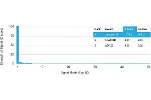 Analysis of Protein Array containing more than 19,000 full-length human proteins using Uroplakin 1B Mouse Monoclonal Antibody (UPK1B/3102) Z- and S- Score: The Z-score represents the strength of a signal that a monoclonal antibody (MAb) (in combination with a fluorescently-tagged anti-IgG secondary antibody) produces when binding to a particular protein on the HuProtTM array. (Uroplakin 1B 抗体  (AA 109-229))