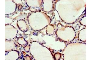 Immunohistochemistry of paraffin-embedded human thyroid tissue using ABIN7152570 at dilution of 1:100 (FUBP3 抗体  (AA 65-260))