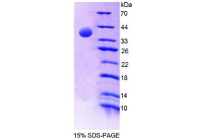 SDS-PAGE analysis of Mouse MTFMT Protein.