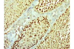 Paraformaldehyde-fixed, paraffin embedded mouse testis; Antigen retrieval by boiling in sodium citrate buffer (pH6. (NEK11 抗体  (AA 151-250))