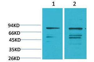 Western Blotting (WB) image for anti-Phosphoinositide 3 Kinase, p85 alpha (PI3K p85a) antibody (ABIN3181561) (PIK3R1 抗体)