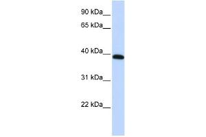 WB Suggested Anti-HOXA10 Antibody Titration:  0. (HOXA10 抗体  (Middle Region))