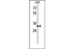 Western blot analysis of ELOVL4 Antibody (C-term) in 293 cell line lysates (35ug/lane). (ELOVL4 抗体  (C-Term))
