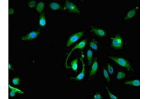 Immunofluorescent analysis of Hela cells using ABIN7163206 at dilution of 1:100 and Alexa Fluor 488-congugated AffiniPure Goat Anti-Rabbit IgG(H+L) (PIGA 抗体  (AA 443-484))