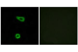 Immunofluorescence analysis of HuvEc cells, using TNAP2 antibody. (TNFAIP2 抗体  (Internal Region))