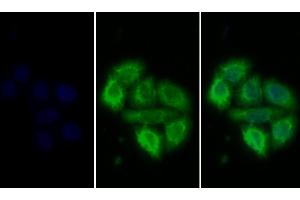 Detection of PRLR in Human MCF7 cell using Polyclonal Antibody to Prolactin Receptor (PRLR) (Prolactin Receptor 抗体  (AA 25-234))