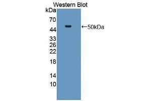 Western blot analysis of the recombinant protein. (HYAL1 抗体  (AA 40-449))