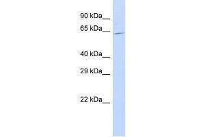 Host:  Rabbit  Target Name:  SLC25A13  Sample Type:  721_B Whole Cell lysates  Antibody Dilution:  1. (slc25a13 抗体  (C-Term))