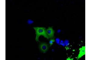 Image no. 5 for anti-Bruton Agammaglobulinemia tyrosine Kinase (BTK) antibody (ABIN1496973) (BTK 抗体)