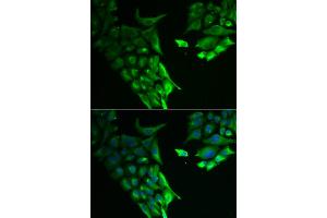 Immunofluorescence analysis of A549 cells using HABP2 antibody (ABIN5974163).